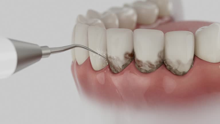 Reliable Emergency Dentist contractor in Ellendale, ND by Smile Center Dentistry